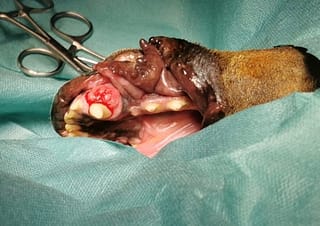 Aspect al unei tumori benigne de la nivel mandibular, cu crestere rapida si invazie osoasa