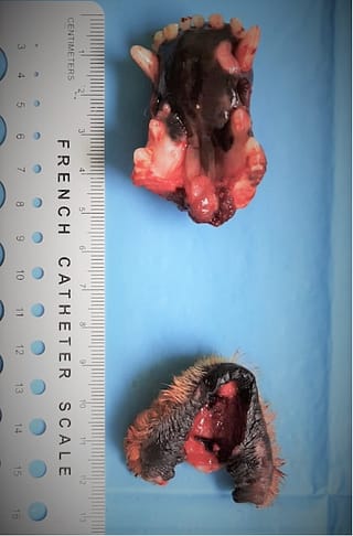 Mandibulectomie rostrala la un caine cu carcinom scuamos retroincisiv