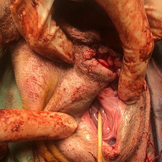 13. Aspect intraoperator in urma realizarii reconstructiei vaginale